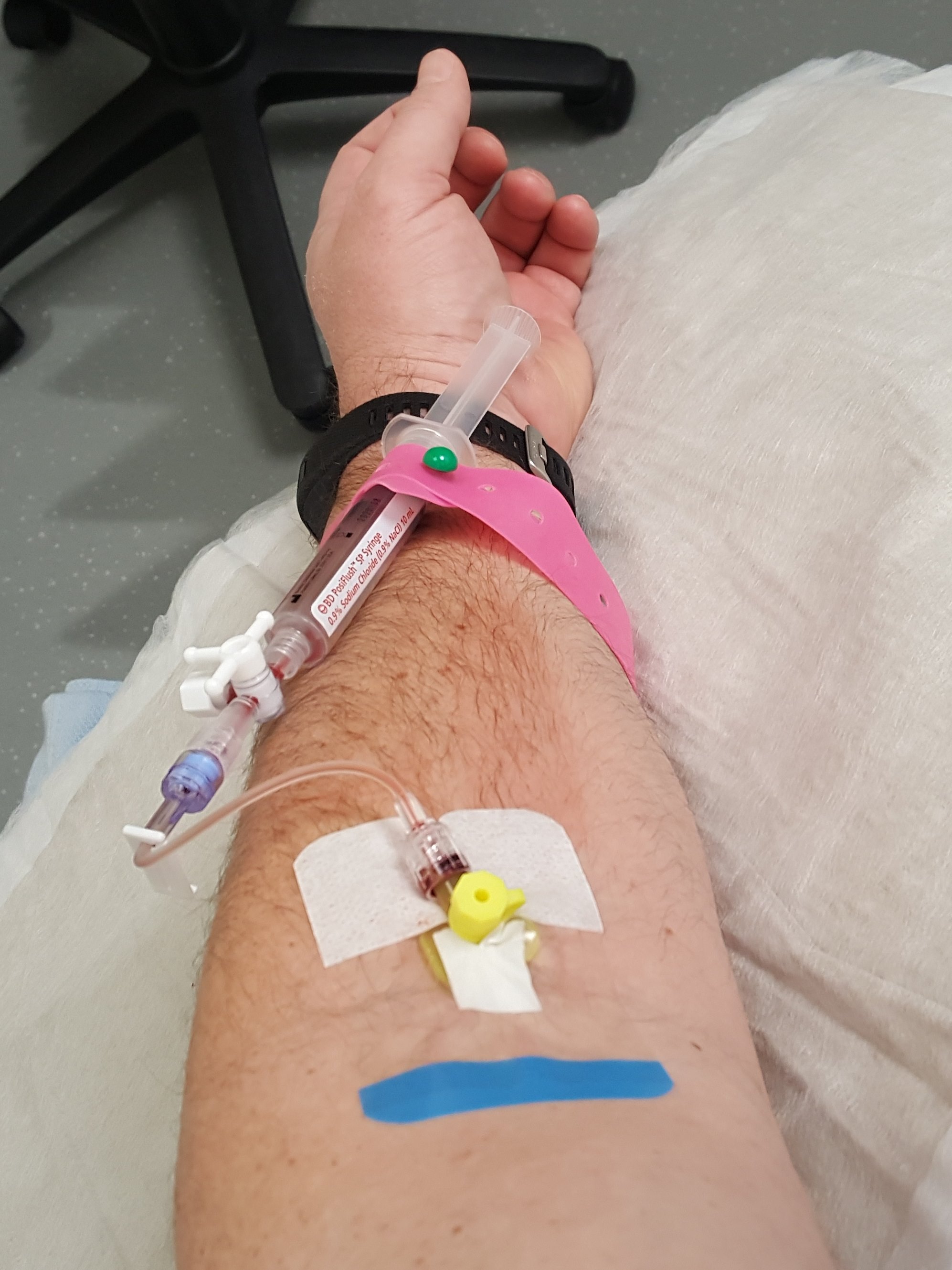 The cannula in my arm waiting to receive the radiotracer as part of a PET-CT Scan
